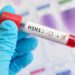 Chile en alerta máxima por una ola de influenza tipo A