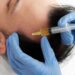 La medicina estética innova con tratamientos ginecológicos y capilares