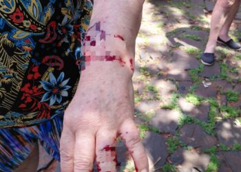 Dos mujeres fueron hospitalizadas tras ser atacadas por pitbulls en Posadas