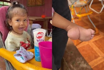 Piden ayuda para una niña de Andresito que necesita cirugía para caminar