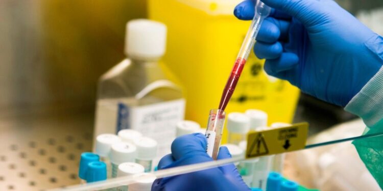 Detectan en Argentina seis casos de un rarísimo grupo sanguíneo