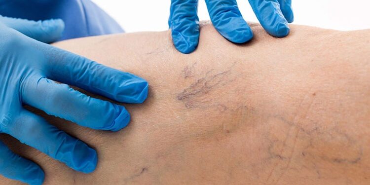 El Parque de la Salud realiza una campaña de atención vascular integral con cobertura en todos los municipios de Misiones